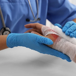 Medical treatment for a serious burn injury